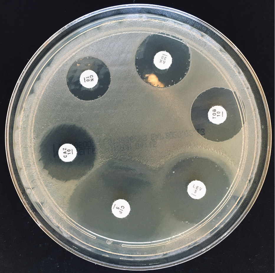 LAB_1_20_Damian_Sztucki_PATOGEN_PSEUDOMONAS_AERUGINOSA_FOT_4